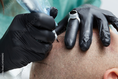 Cosmetologist making permanent makeup on man head - tricopigmentation