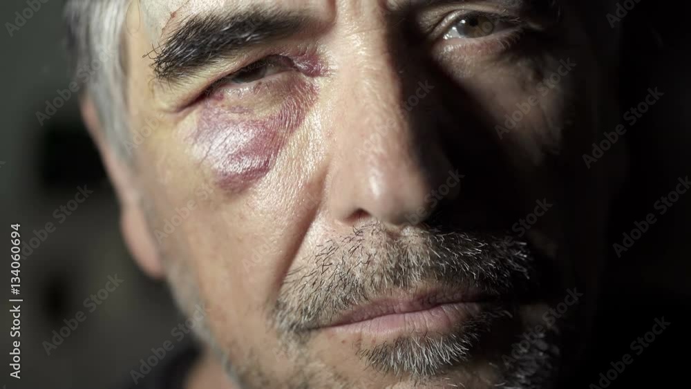 middle-aged boxer with black eye middle-aged boxer with black eye