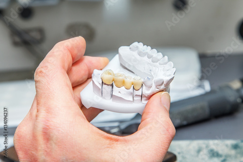Technical shots on a dental prothetic laboratory photo