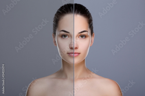 Принти на полотні Comparison portrait with acne and retouch