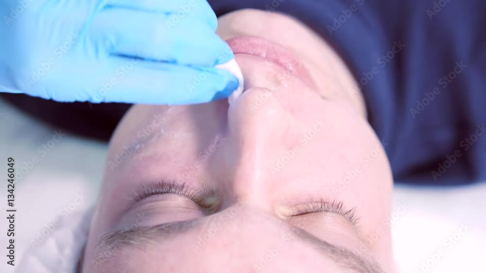 Medical modern innovative laser equipment. Procedure for laser resurfacing skin. Medical modern innovative laser equipment. Procedure for laser resurfacing skin.