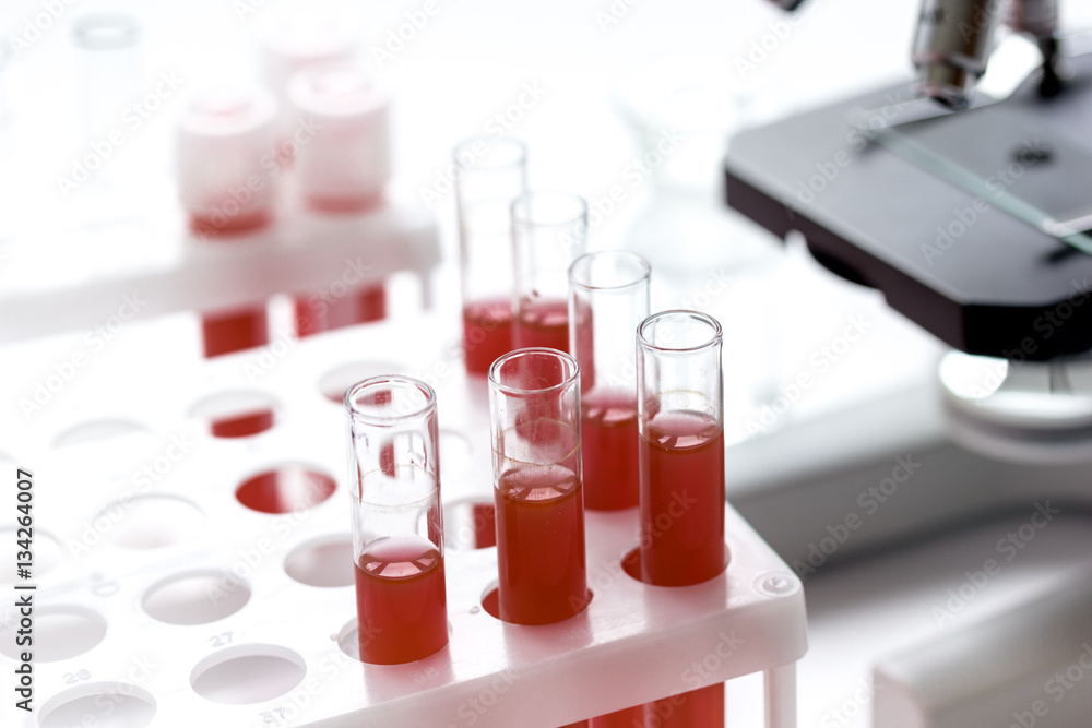 Medical equipment blood test in laboratory no one Medical equipment blood test in laboratory no one