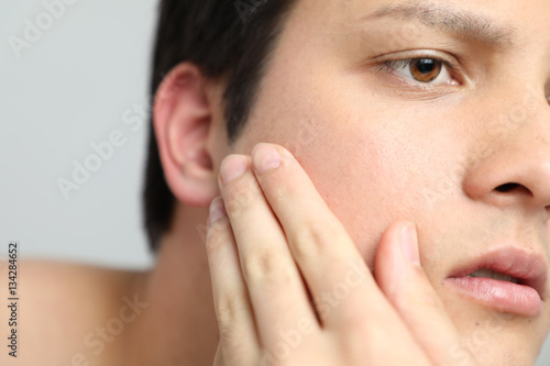 Young man checking his skin, men's skincare concept, acne treatment