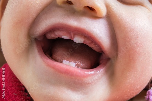 Closeup view on open mouth of baby. First teeth growing.