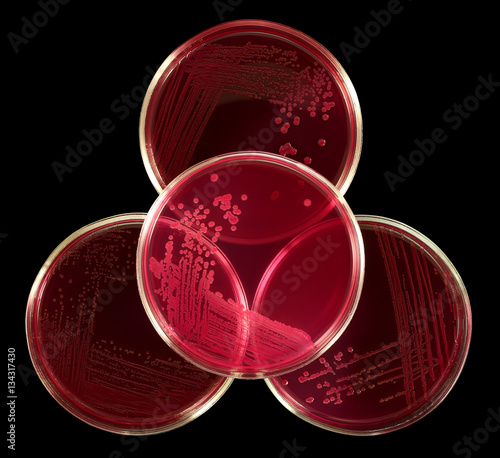 Biohazard / biosafety sign composed by glass petri plates with red agar Endo. Colonies of Escherichia coli enteric intestinal bacteria. Isolation by pen.