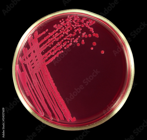 Lactose - negative Escherichia coli bacteria microbe on the red agar Endo. Close-up. Isolation by pen.