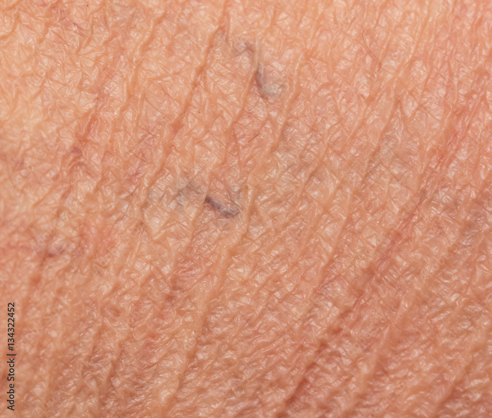 Fototapeta premium varicose veins on the skin as a background