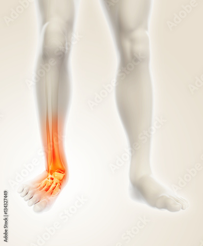 Ankle painful - skeleton x-ray.