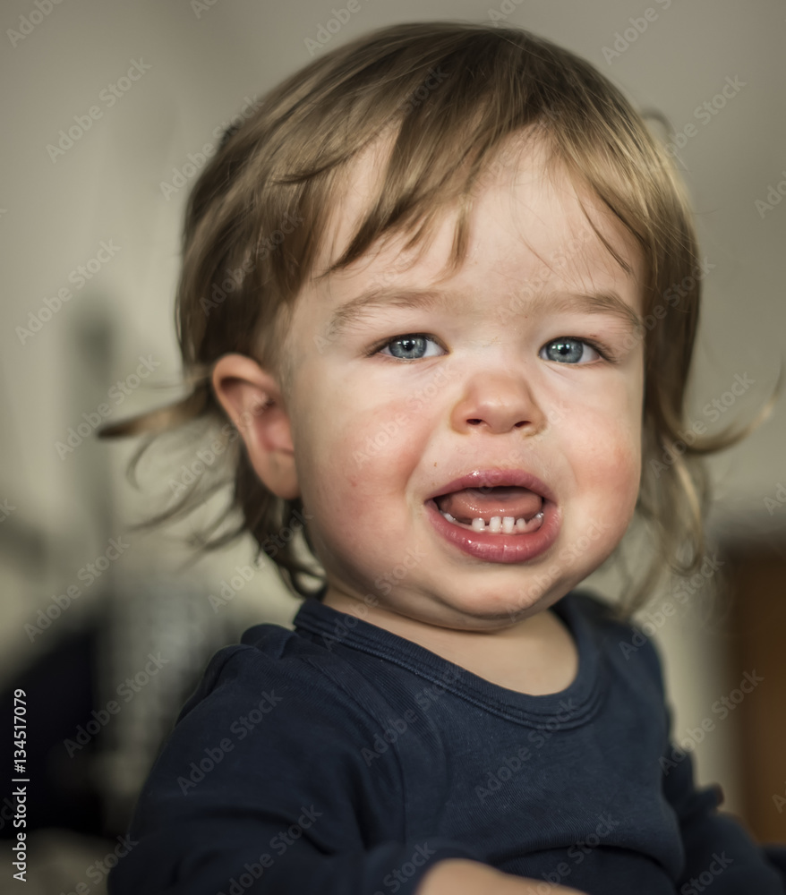 bambino affetto da nanismo bambino affetto da nanismo