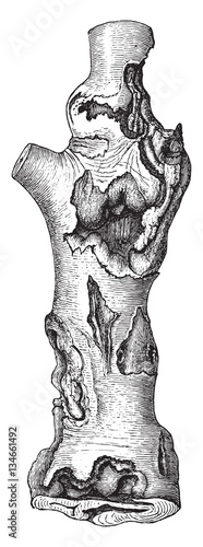 Stem with many beech canker, vintage engraving.