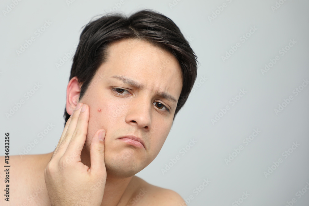 young man caring about acne, men's skincare concept young man caring about acne, men's skincare concept