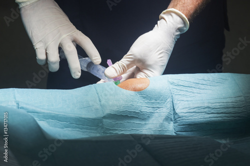 Knee surgery anaesthetic injection photo