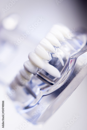 Dentists dental teeth model