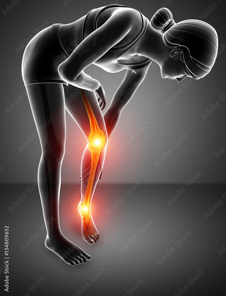 Pain in leg Pain in leg