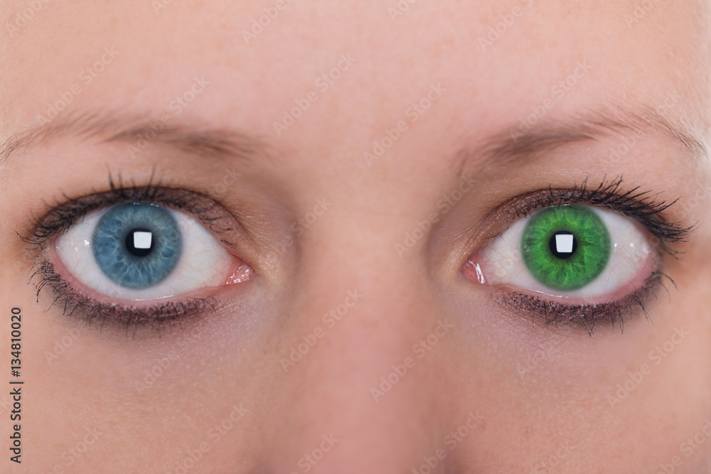 Frau mit Iris Heterochromie, Augenfarbe grün und blau, Kontaktl