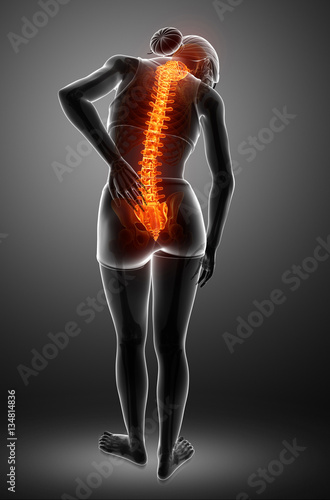 Women Feeling the Back pain