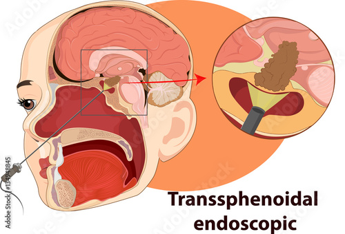 Vector illustration of Examination endoscopic anatomy
