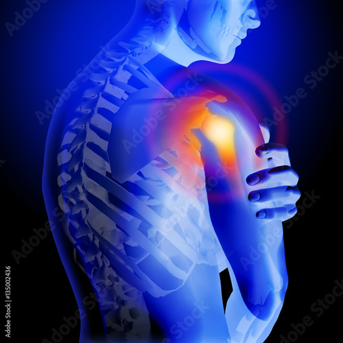 Shoulder pain. X-ray of the skeleton and body. Anatomical body of a man. 3d medical illustration.