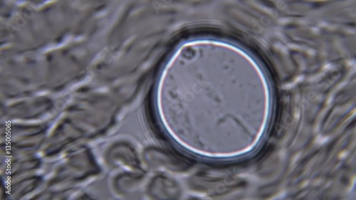 Footage on the theme blood, diseases, interstitial fluid, bacterial background, research using a microscope at extreme magnification of about 1000x