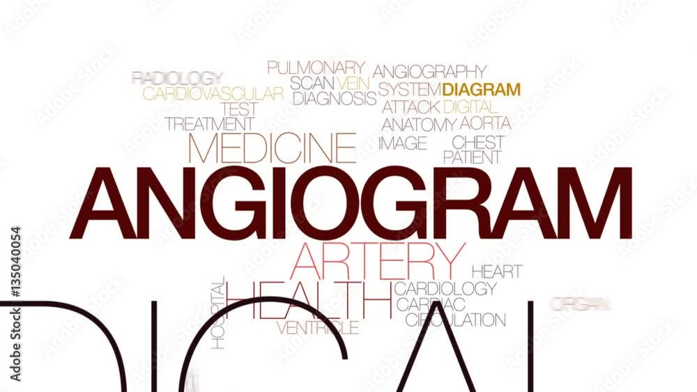 Angiogram animated word cloud, text design animation. Kinetic typography. Angiogram animated word cloud, text design animation. Kinetic typography.