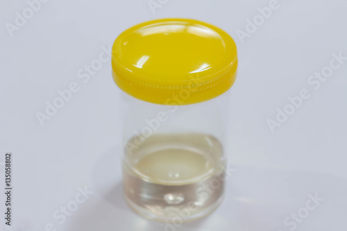 Urine sample