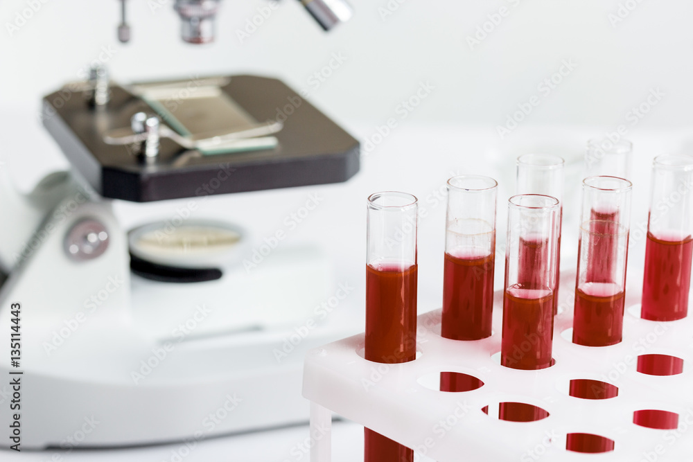 blood in glass tubes on background of microscope blood in glass tubes on background of microscope