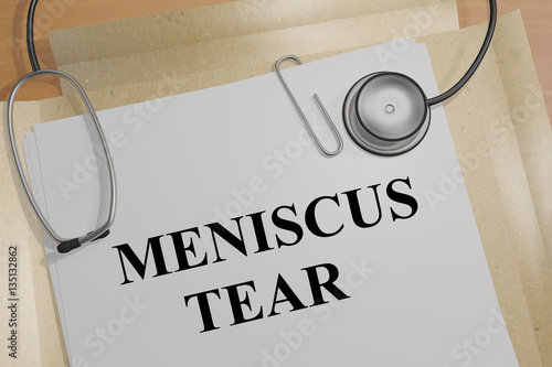 Photography Meniscus Tear - medical concept