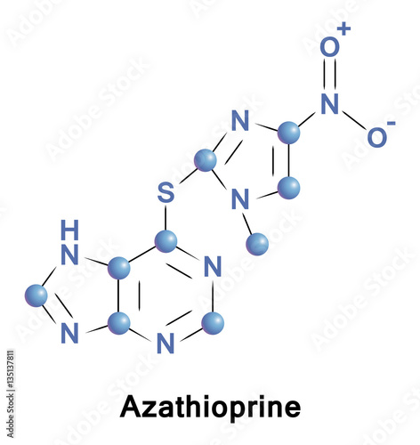 Azathioprine is an immunosuppressive medication. It is used in rheumatoid arthritis, Crohn disease, ulcerative colitis, and in kidney transplants to prevent rejection
