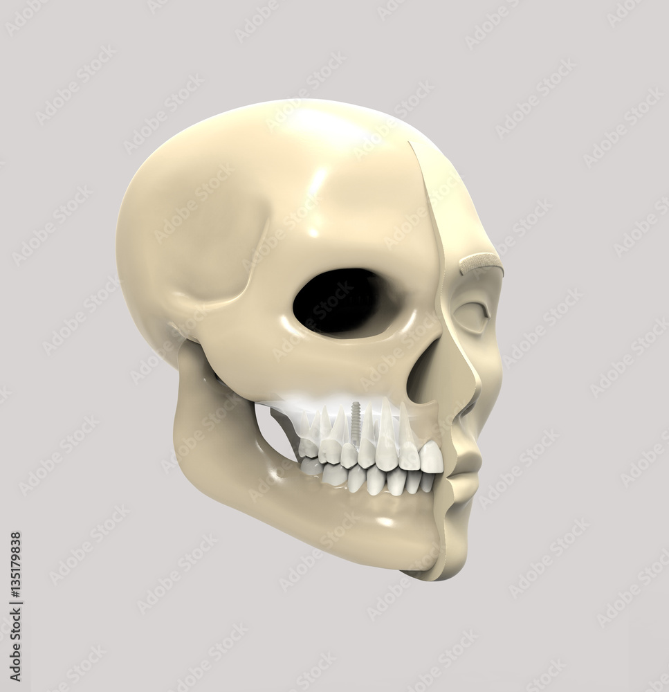 Obraz premium 3D rendering implant