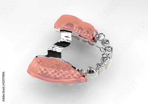 3D rendering dentures