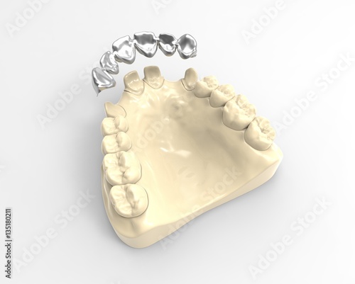 3D rendering dentures