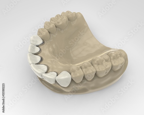3D rendering dentures