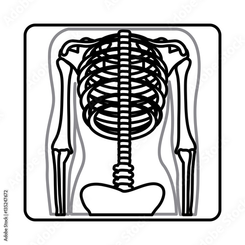 monochrome silhouette with x-ray of bones vector illustration