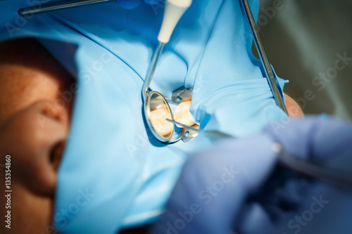 Patient getting dental treatment with dental rubber dam protection photo