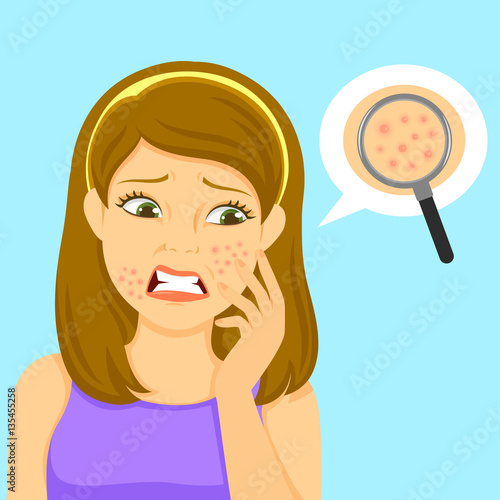 unhappy girl with pimples on her face