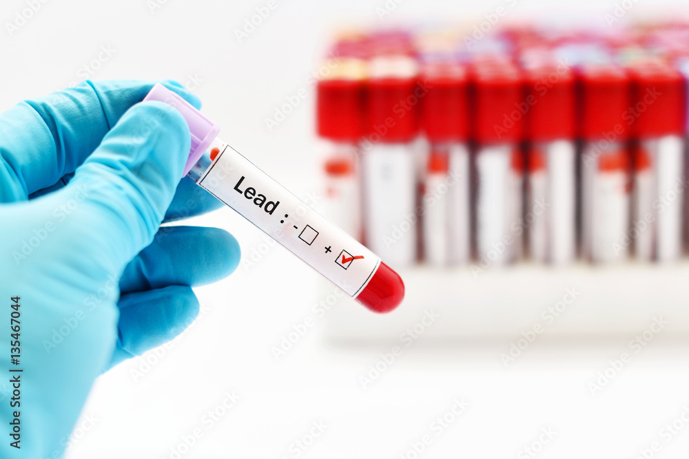 Fototapeta premium Blood sample positive with lead (Pb) test