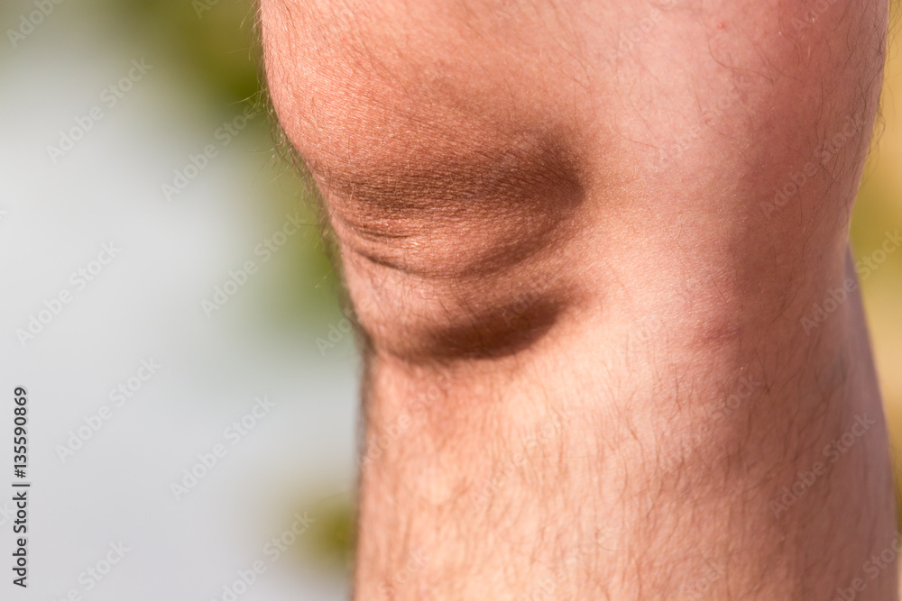 Fototapeta premium leg man. macro