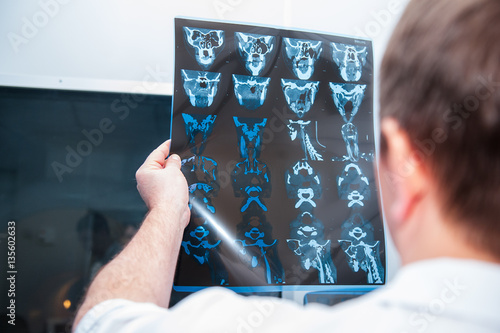 Doctor looking at magnetic resonance image (MRI) of the head. Back view, selective focus
