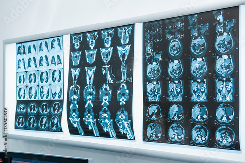 Several resonance imaging (MRI) of the brain. Selective focus photo