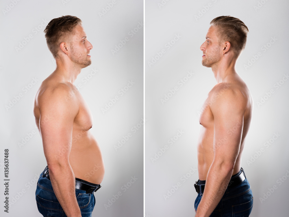 Young Man Before And After Loosing Fat Young Man Before And After Loosing Fat