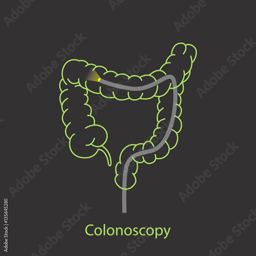 colonoscopy logo vector icon design