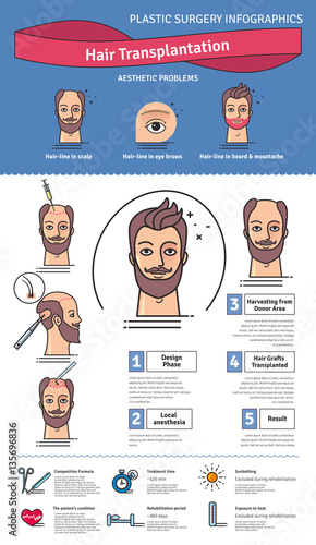 Vector Illustrated set with hair transplant surgery