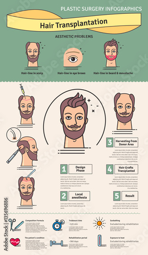 Vector Illustrated set with hair transplant surgery