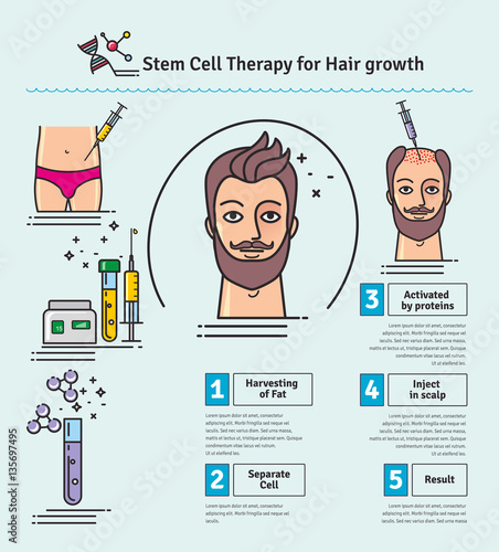 Vector Illustrated set with stem cell therapy for hair growth