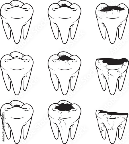 Tooth Caries vector icon. Style is a flat tooth caries black and white iconic symbol on a gray square background.