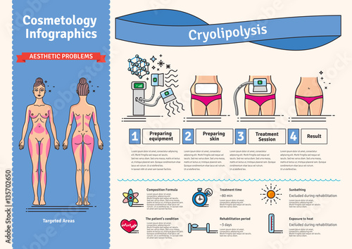 Vector Illustrated set with cosmetology Cryolipolysis treatment