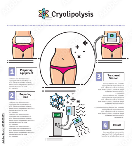 Vector Illustrated set with cosmetology Cryolipolysis treatment