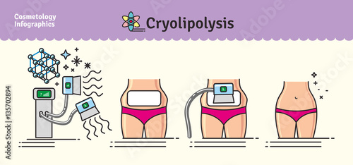 Vector Illustrated set with cosmetology Cryolipolysis treatment