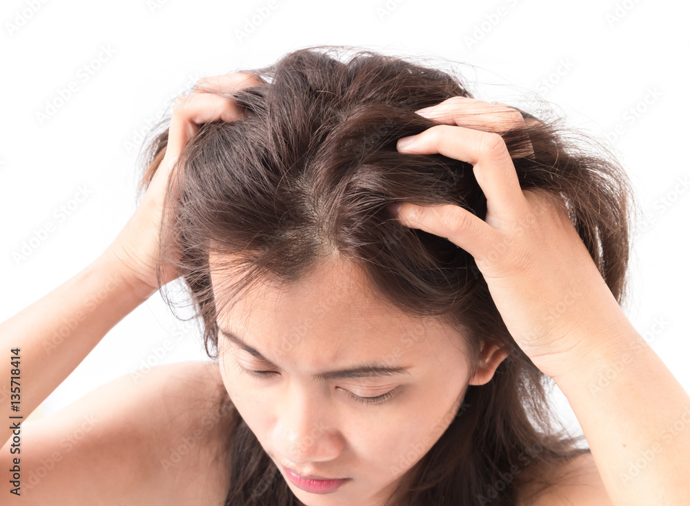 Closeup woman hand itchy scalp, Hair care concept Closeup woman hand itchy scalp, Hair care concept