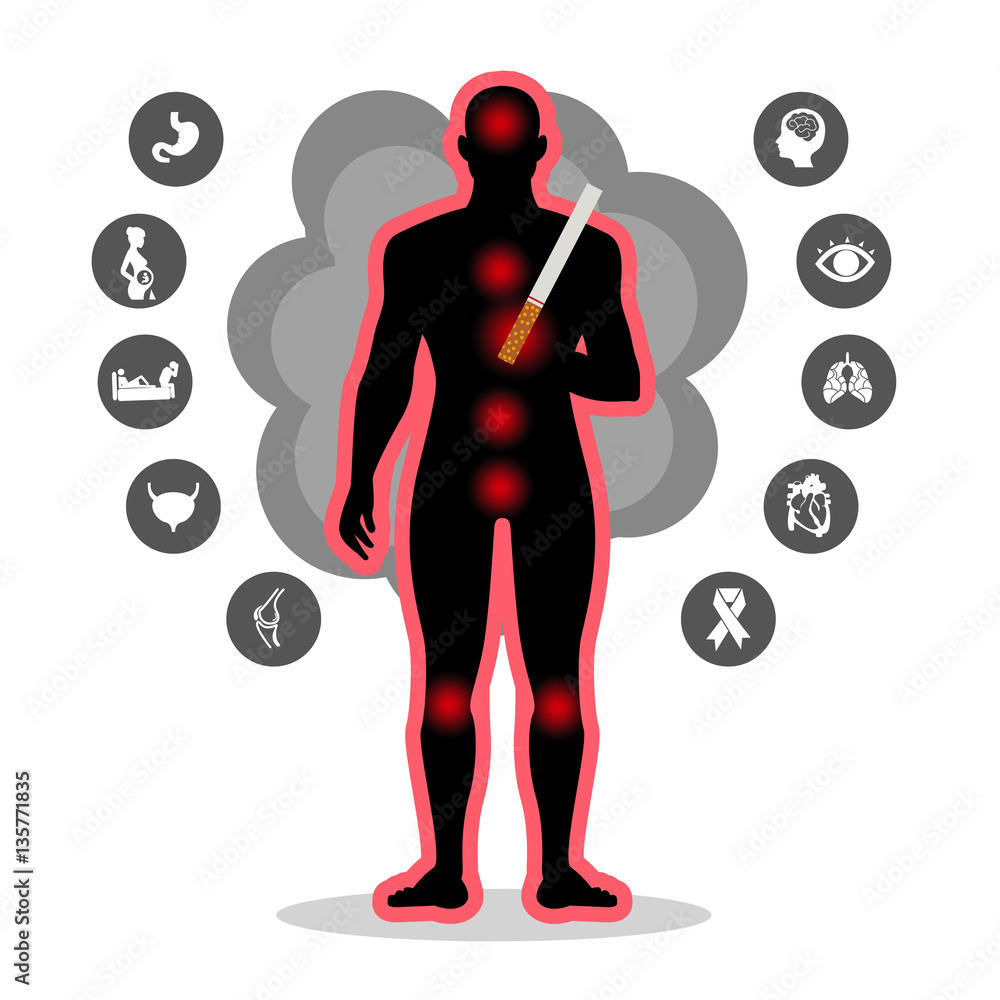 Health effects of cigarette smoking illustration. Lung cancer, high ...